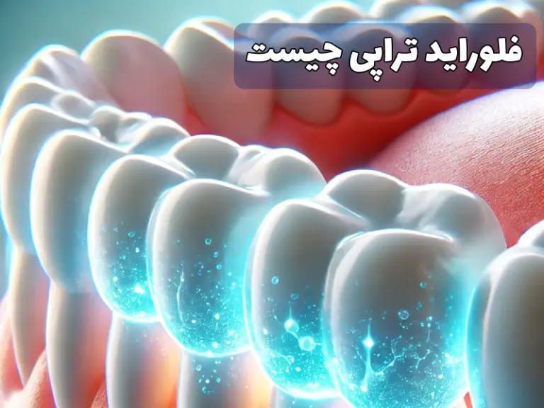 فلوراید تراپی